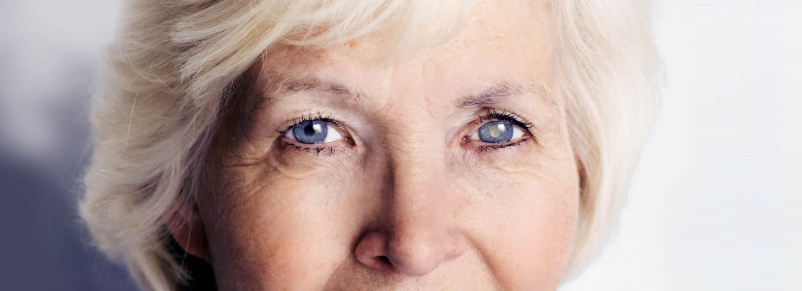 Cataract Surgery in Rigden Farm
