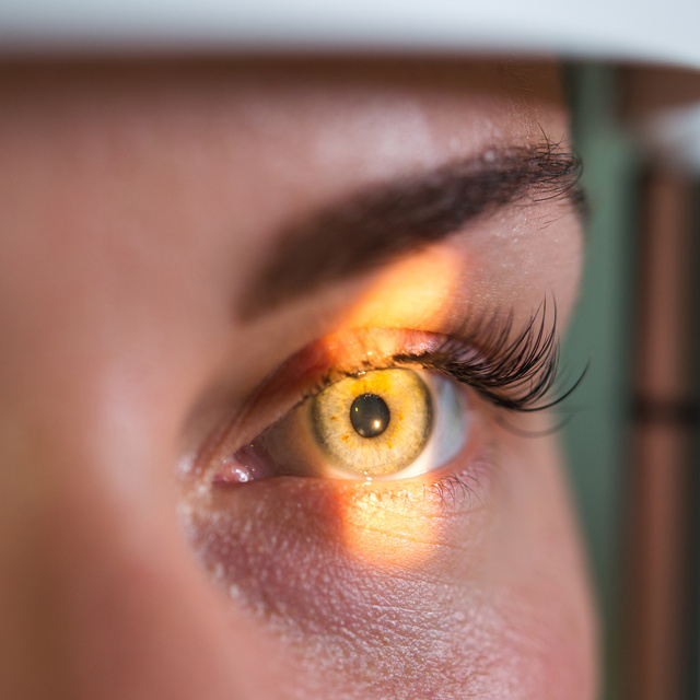Vision Therapy in Rigden Farm